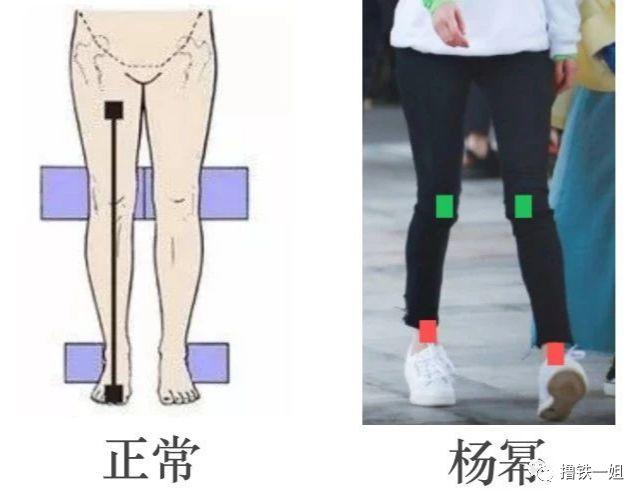 杨幂“醉酒”被拍？这腿真的变形到撑不住身体了！