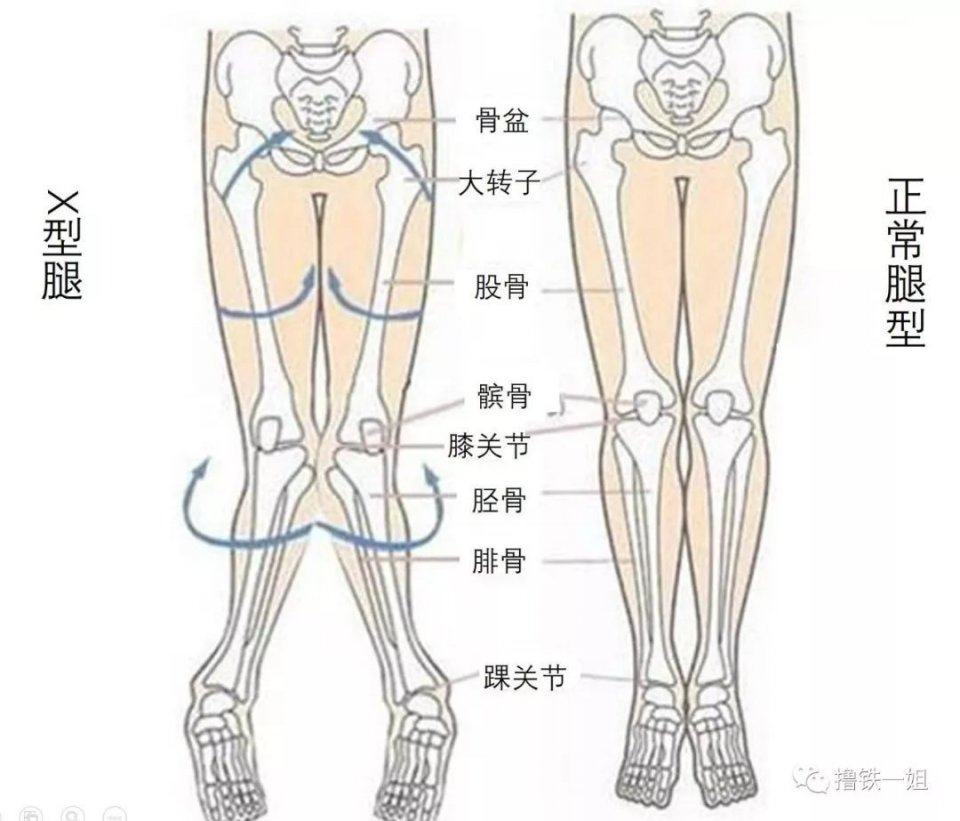 杨幂“醉酒”被拍？这腿真的变形到撑不住身体了！