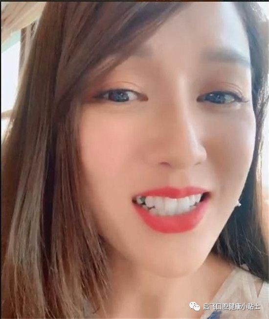 一大早,陈妍希也发了合影. 娜娜岂肯落后?随之也发出与陈乔恩的合照.
