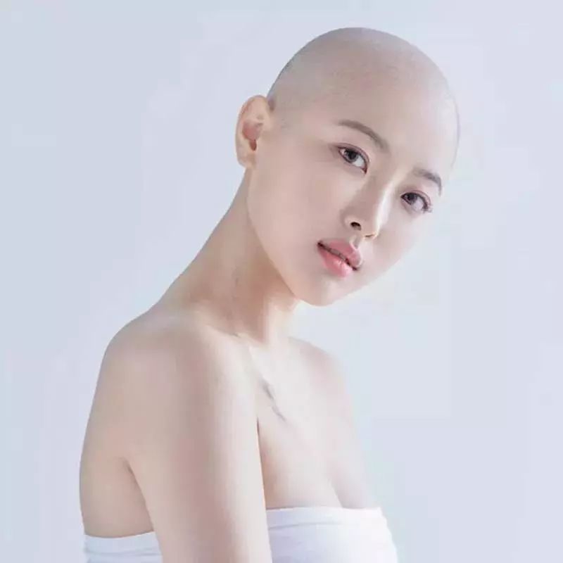 笑对病魔拍光头写真,她说人生不需要被定义.