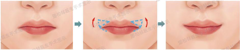 大家心目中的文艺女神虽然是内牛五方脸，但下唇暗藏着小心机