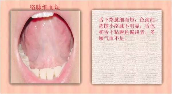 中医医生总看舌头都在看什么九种体质珍贵的舌诊图谱