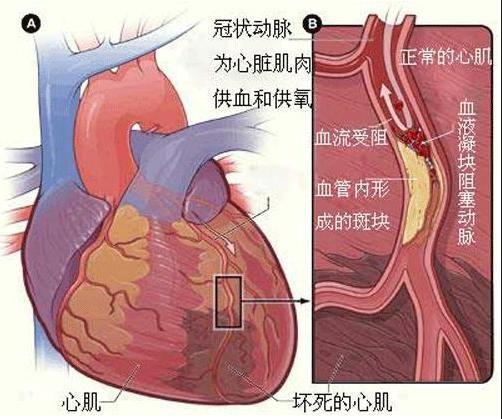 心脏造影多少钱报销吗 做过心脏造影能买保险么