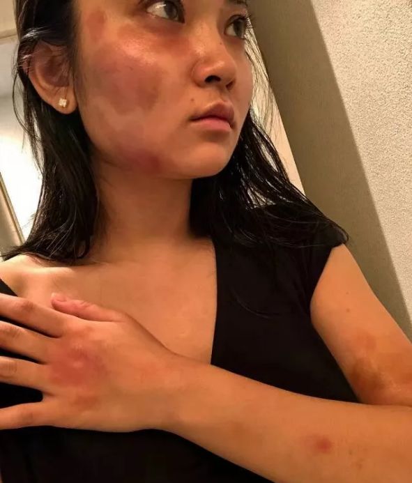 蒋劲夫在日本自首被捕！女友被锤子打掉两颗牙齿还被踢流产家里全是血…