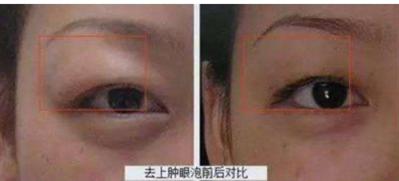 婚后臃肿变老的宋慧乔又美回来了，新剧竟比小12岁男主还嫩！