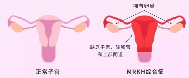 世界首个已故捐献者子宫移植孕育的婴儿诞生