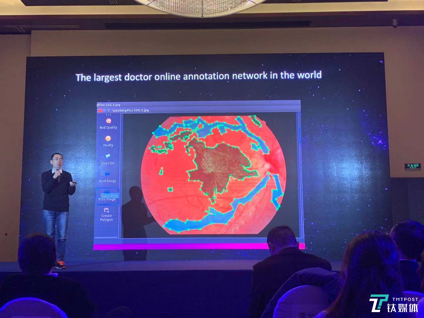 星创视界、Airdoc、春雨医生等五方签约联盟，打造AI视健康服务链 | 钛快讯