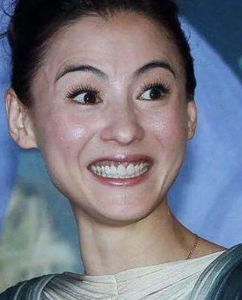 可怕！当红女明星脸上集体出现了这个东西！