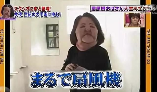 韩国美女明星整容上瘾，导致脸部变形毁容，睡觉都无法闭上眼！