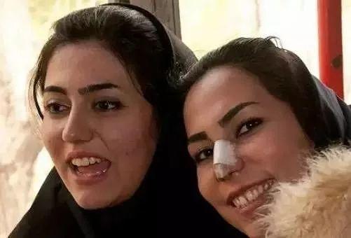 12岁整鼻到20岁还没拆绷带，只是为了炫富？