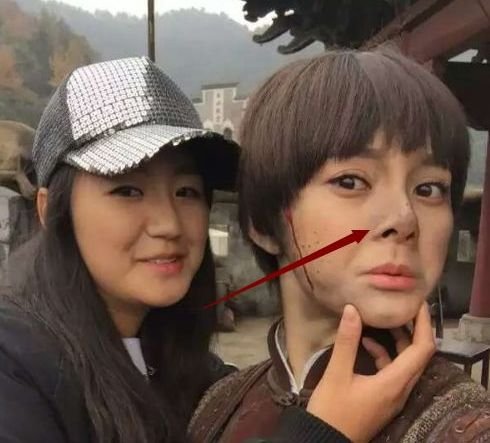 王凯初恋整成低配版沈梦辰！连她整形后遗症的朝天鼻也照搬了···