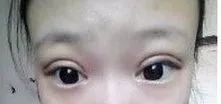 瞎整派掌门人杨紫终于翻身了，这个部位整得一雪前耻！