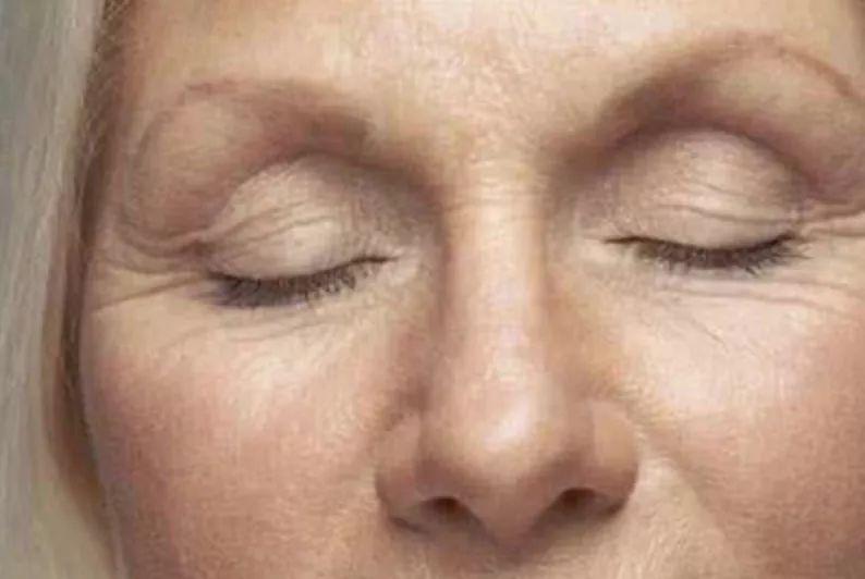 张雨绮打在腋下狐臭处的针,林允缺钱也打了脸