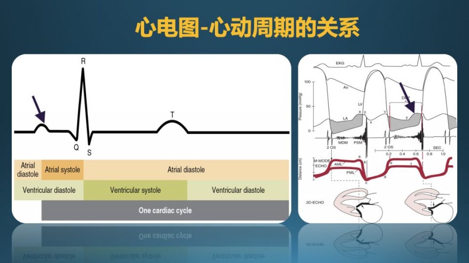 如何在心电图及心脏超声中识别并理解心动周期?
