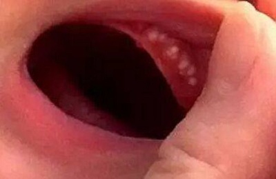 马牙5.jpg
