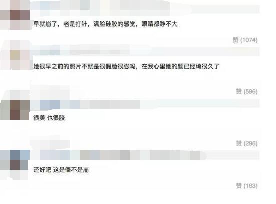 张柏芝路人近照曝光，网友惊呆：满脸硅胶眼睛都睁不大