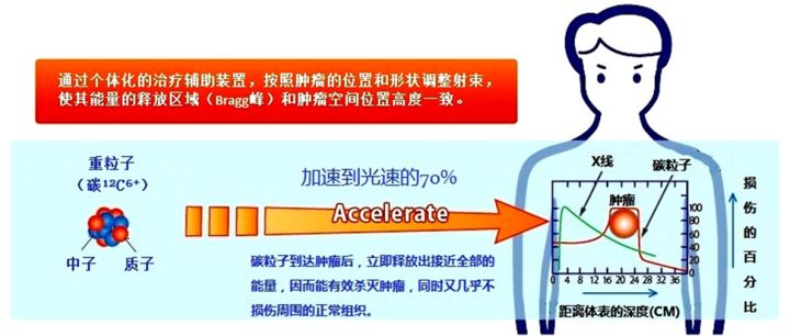 华西院长：最先进的癌症治疗中心 落户成都