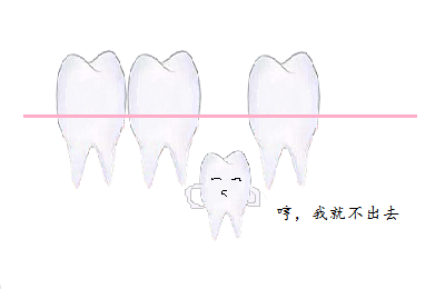 埋伏牙.png