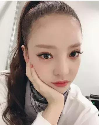 大方承认整容的她，却因为抑郁轻生上热搜
