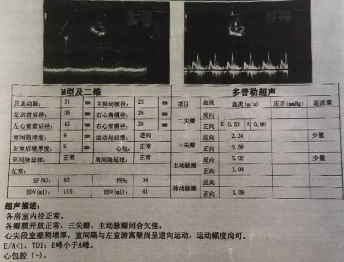 图2. 外院a超声心动图.