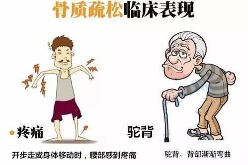 专家带你了解骨质疏松—许国华教授科普系列