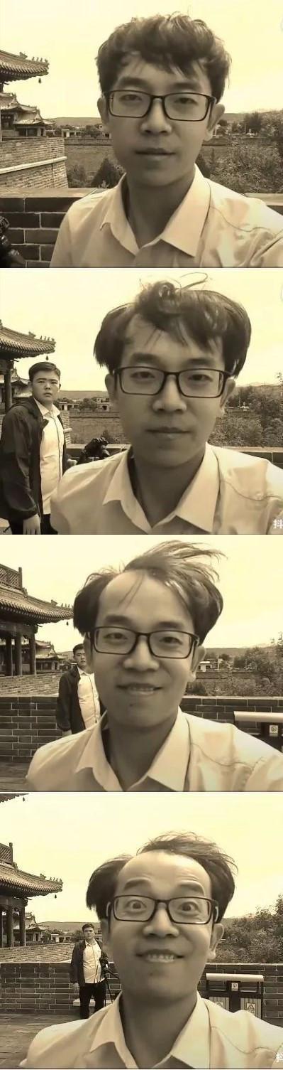 第一批90后已经秃了!你为什么“英年早秃”?