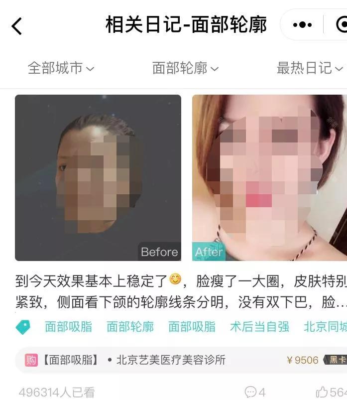 忽悠2000万中国女性，年赚千亿，卖假药的整容APP们，到底多无耻？