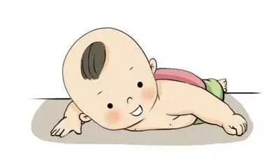高温夏季来袭,宝宝除了长痱子以外,还要注意“淹脖子”问题