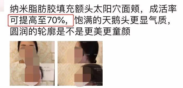 回春没多久的杨紫，咋又肿成这样了？