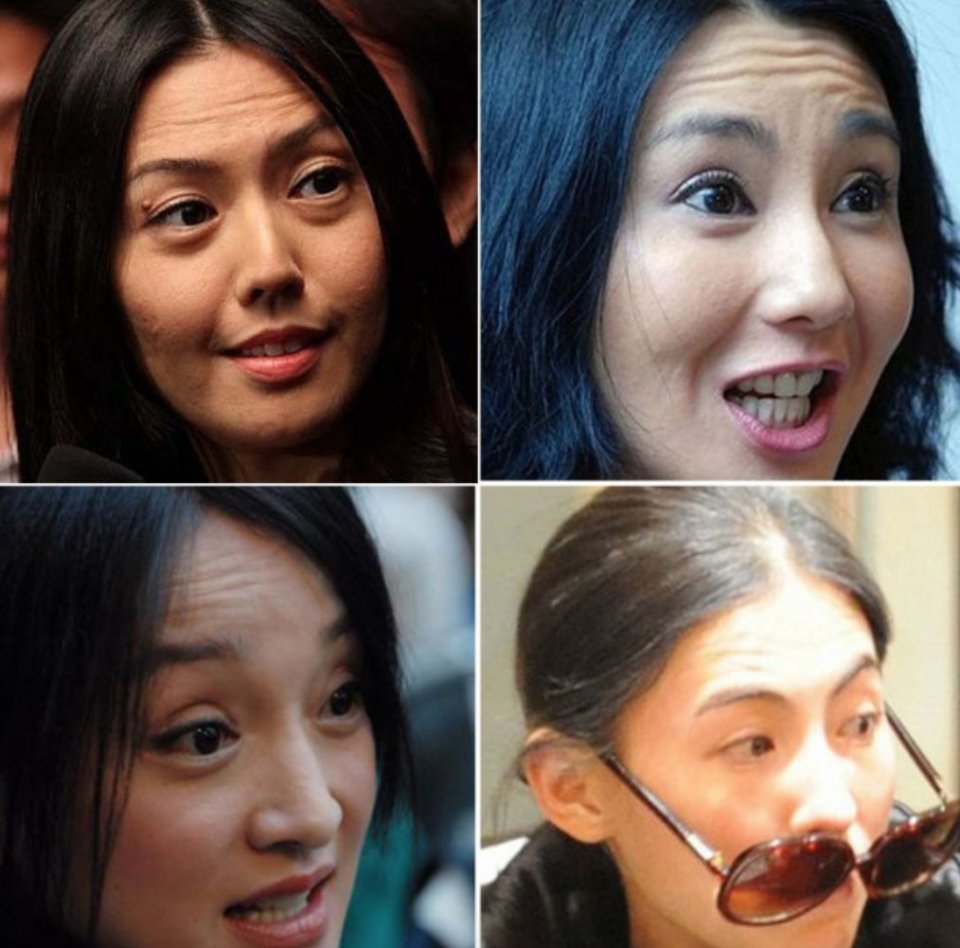 小S公开承认这些地方是整的！她是又喝多了吗？