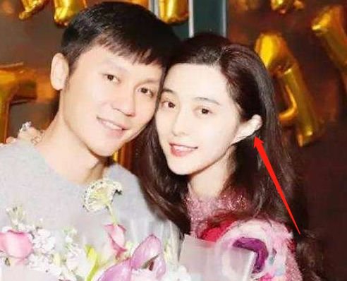 热巴最新直播自爆从小到大最自卑的颜值bug！竟然不是鼻子…