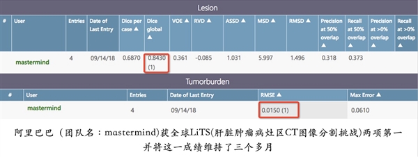 阿里AI肝病诊断两夺世界第一：至今无人超越