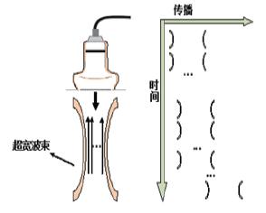 剪切波弹性成像:于细微处见真知