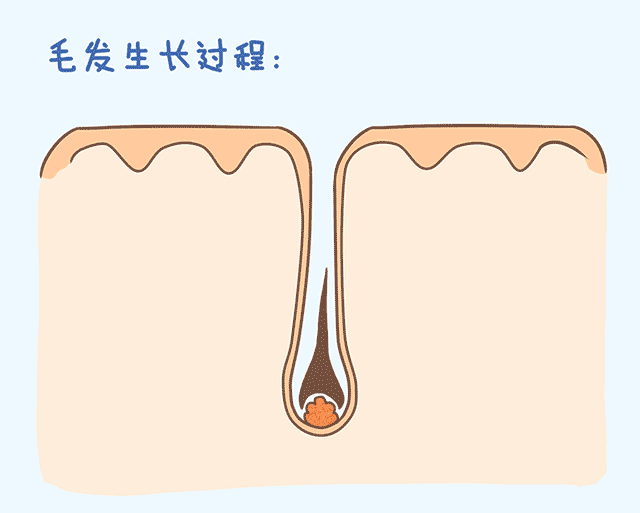 毛囊会不会堵塞?毛囊堵塞会导致脱发?