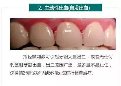 牙龈流血找不出原因？专业牙医说明！
