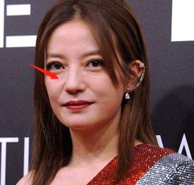 林允儿的神颜也崩了！脸歪+填充成气球，这两道沟又是什么鬼？