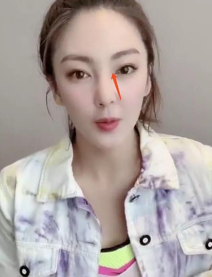 张雨绮鼻子歪到天边的视频都敢往外发！团队是集体造反了？