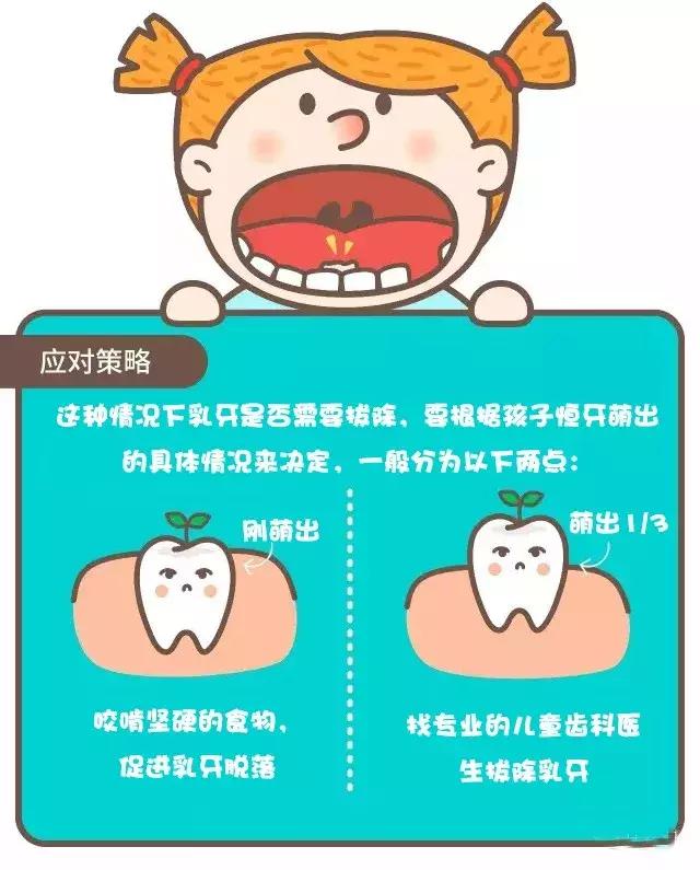 换牙,蛀牙?家有5-12岁小孩的父母必看攻略!