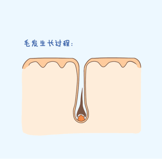 激光脱毛一次讲完 & 常见问题解答