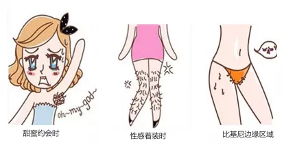 激光脱毛一次讲完 & 常见问题解答