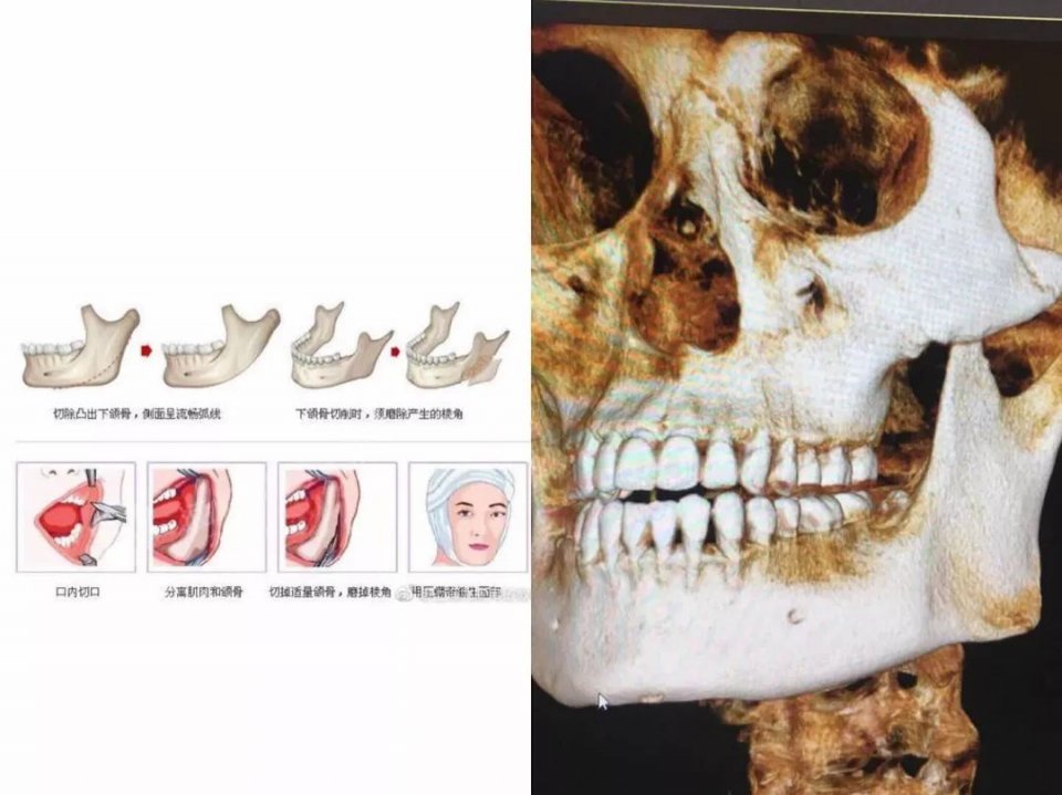 顶流小花颜值集体崩塌，她却悄悄美到“超越审美基线”