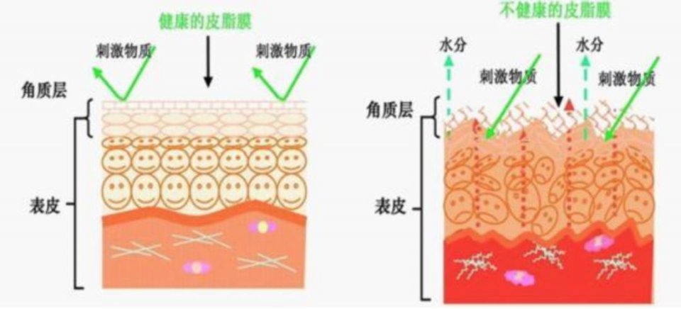 皮脂膜出现问题的时候,我们涂普通的补水产品是没有太大作用的,所以要