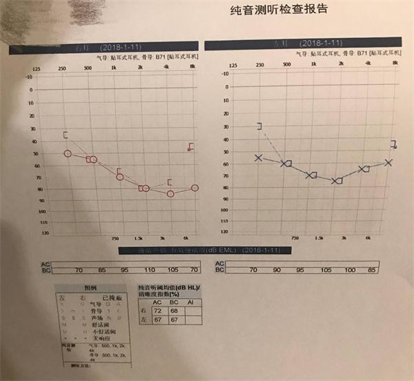 职业健康检查|一文教你了解听力测试那些事儿
