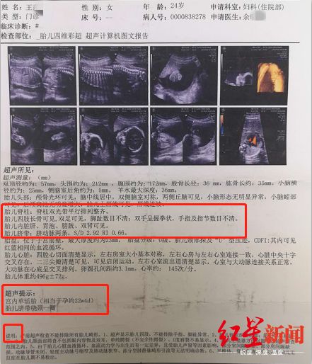 达州孕妇5次超声检查却生下畸形宝宝医疗执法部门医院无责