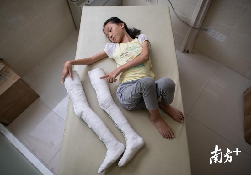 这是我的大长腿茂名化州残疾女孩杨思莹到广州定制支具了
