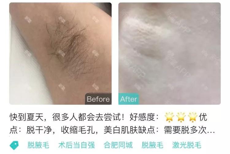 忽悠2000万中国女性，年赚千亿，卖假药的整容APP们，到底多无耻？