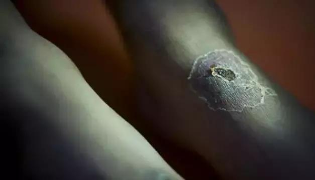 吸毒的人寿命有多长?真相原来是这样