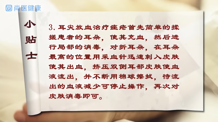 耳尖听听v卡通毒,放血卡通性感,古风真是假?来消除面部女这是痤疮头图片