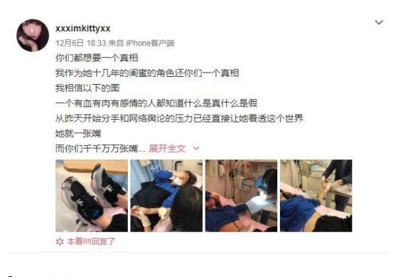 Naomi不堪舆论压力割腕，因丑闻曝光，竟跟陈冠希有过一腿？