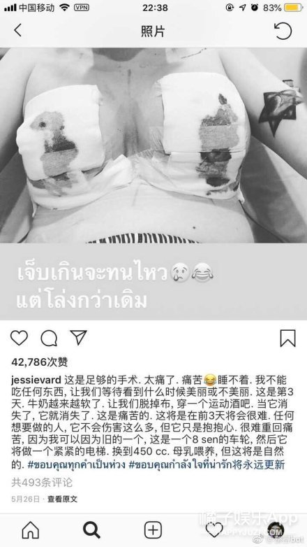 晚报|金莎为翻唱歌曲找寻著作人 爱尔兰名模整容过程曝光